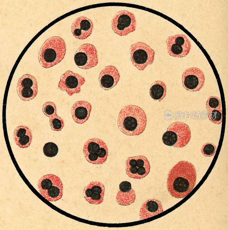 人类胎儿有核红细胞的显微镜观察- 19世纪